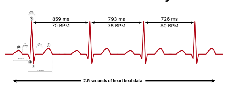 Heart Rate Variability - example